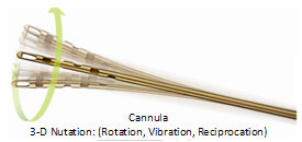 3-D cannula