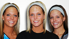 photo of the berns triplets