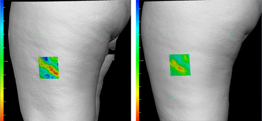 Cellulaze: Photos, News, Cost, Reviews, Locate Provider - AHB