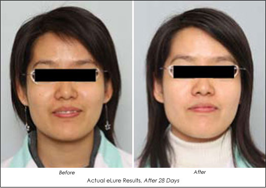 elure skin brightening system