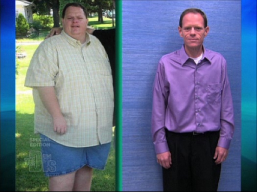 extreme weight loss before after