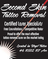 Second Skin Laser Tattoo Removal